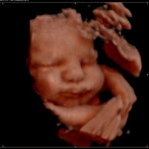 Meet your Posher, Stacey